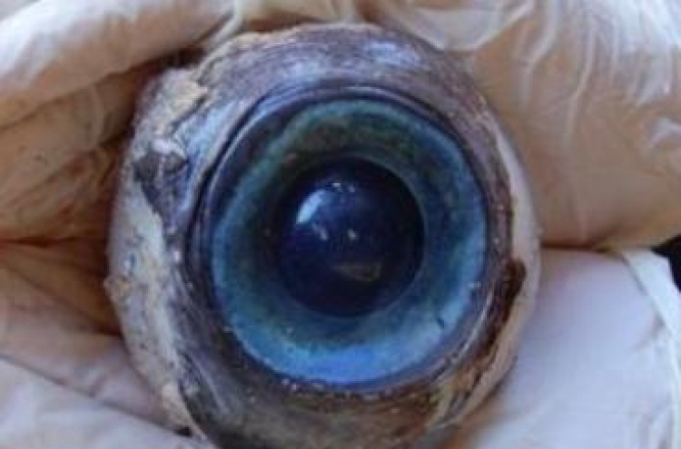 Mystery of giant eyeball solved