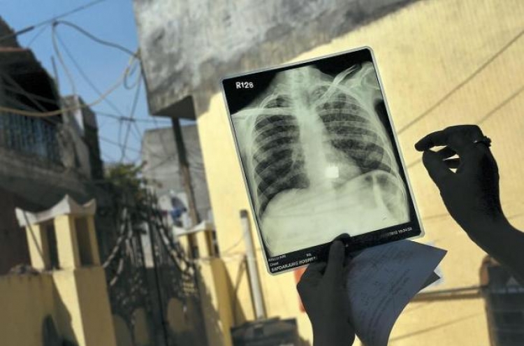 India wages hi-tech war on ancient scourge: tuberculosis