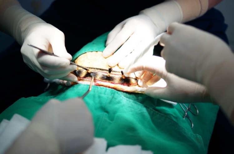 New hair transplant device developed to improve success rate