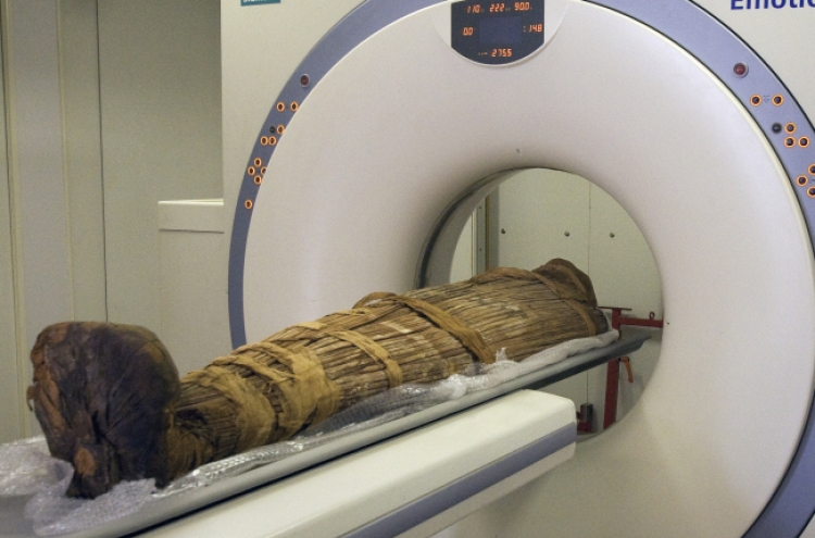 Even ancient mummies had clogged arteries: study