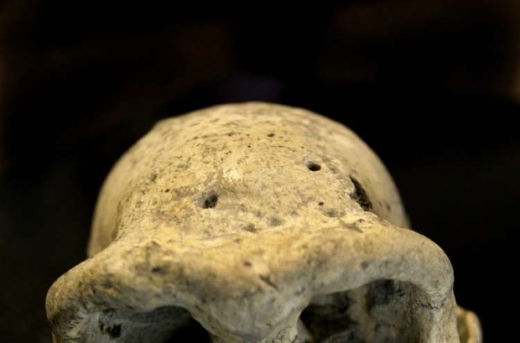 1.8M-year-old skull gives glimpse of our evolution