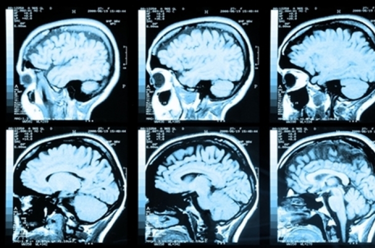 기억 복원시키는 ‘뇌 임플란트’  곧 등장