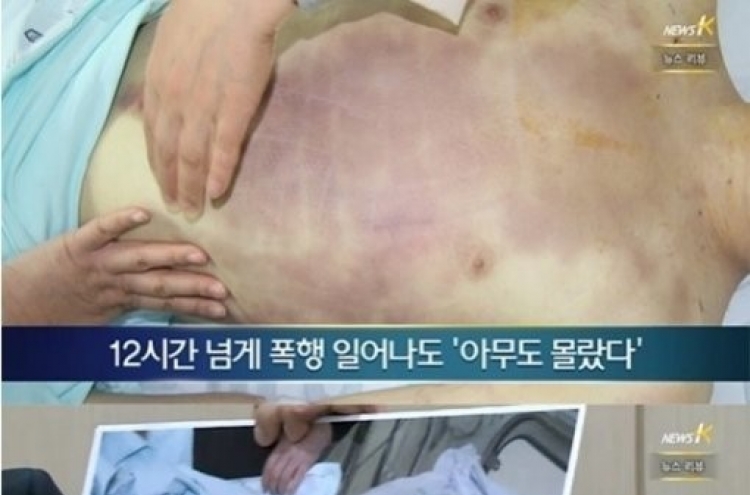 28사단 윤일병 사망사건, 군 수뇌부 문책 거론 관련 청와대 입장은...