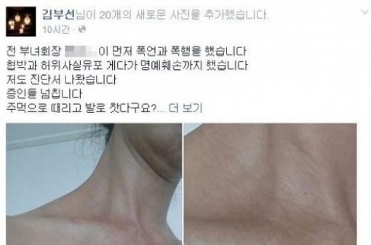 김부선, 폭행 혐의 부인 “전 부녀회장이 먼저 폭행” 멍든 사진 공개