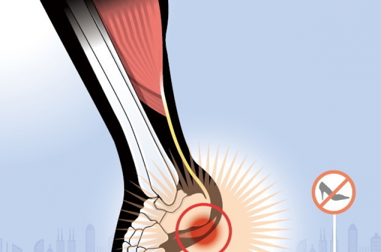 Plantar fasciitis