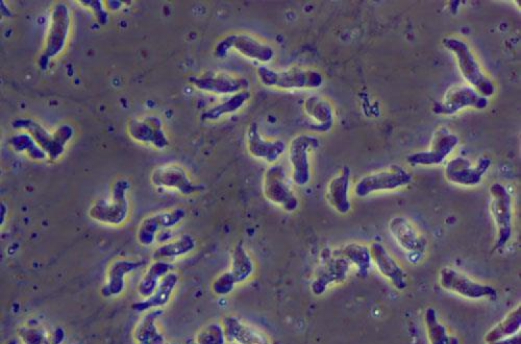 뇌 파먹는 '식인 아메바' 감염 증가…치사율 95%