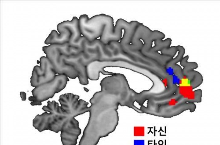 이기적인 사람 이타적인 사람, 뇌활용 부위 달라