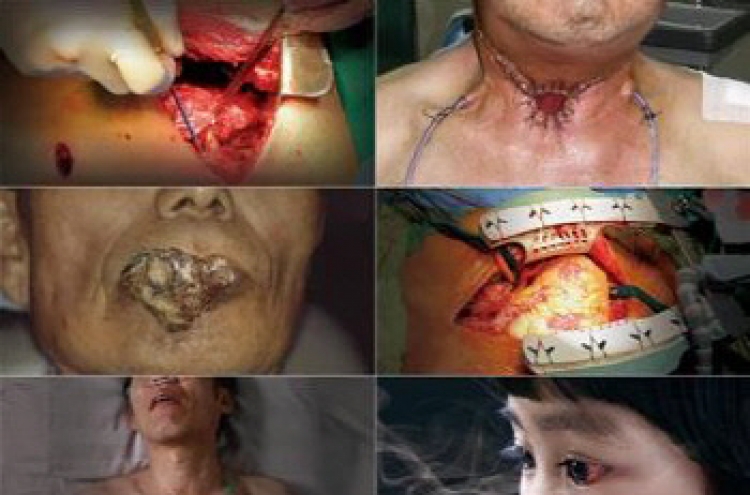 Graphic warnings to appear on all cigarette packs from Dec. 23