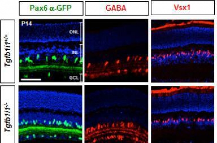 Scientists discover retina cell related to light sensitivity