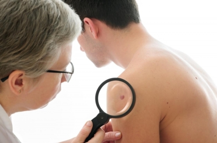 Skin cancer cases soar some 40% over 4 years