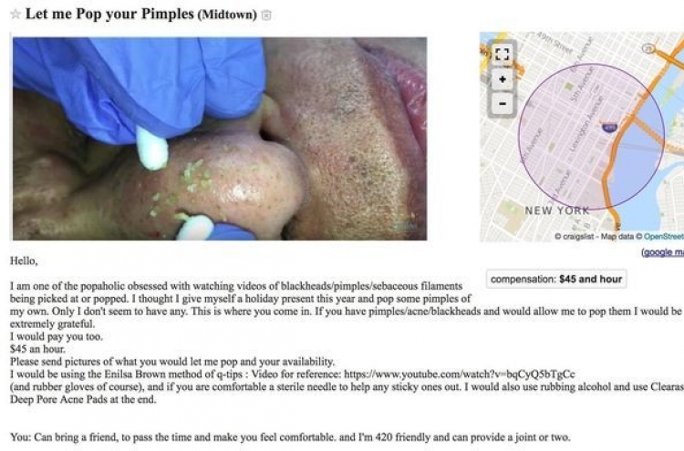 “5만원 줄테니 당신 여드름 짜게 해주세요”