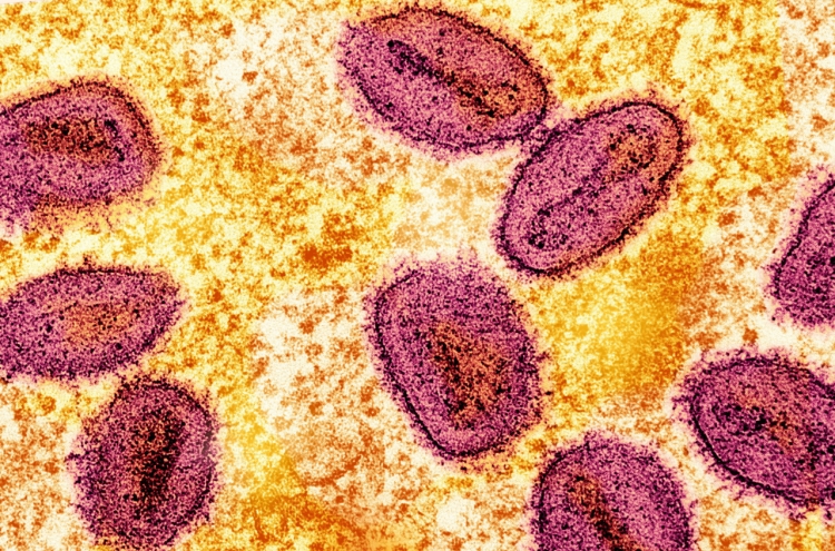 Malaysia reports new mpox case of clade 2 variant