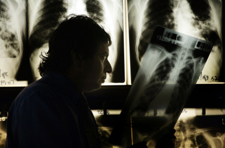 Do you know enough about tuberculosis?