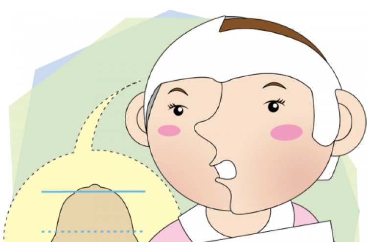 When your child has plagiocephaly