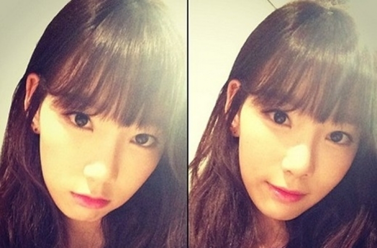 SNSD’s Taeyeon reveals photo after removing wisdom teeth