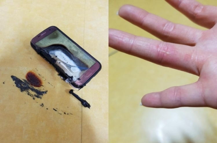 Alleged Samsung Galaxy S7 explosion causes severe burns