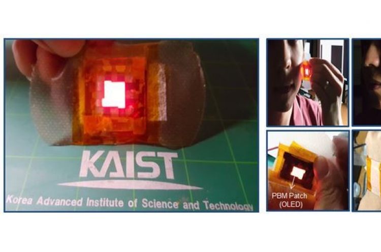 Korean researchers develop ‘OLED patch’ that heals wounds using light