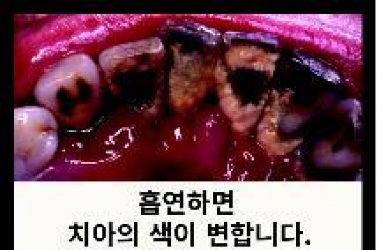 S. Korea to change graphic warnings on cigarette packs in December