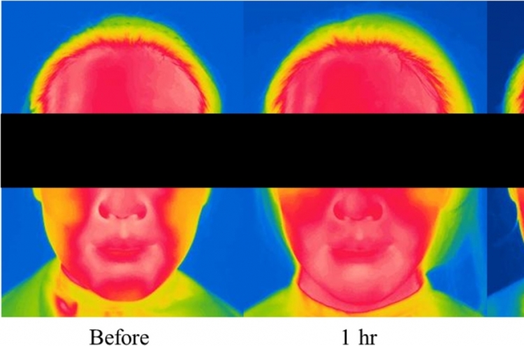 Amorepacific study shows harmful impact of mask wearing on skin