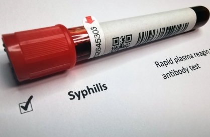 Syphilis cases in S. Korea surge amid stricter reporting rules