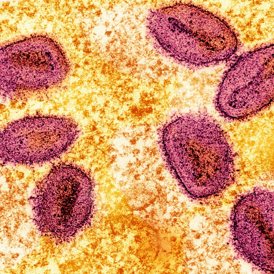 Malaysia reports new mpox case of clade 2 variant