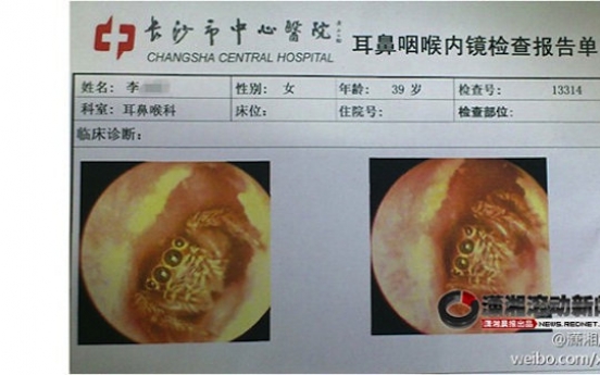 Chinese doctors remove spider from patient’s ear canal