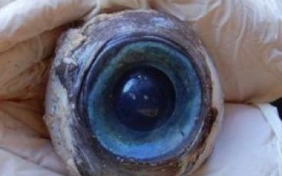 Mystery of giant eyeball solved