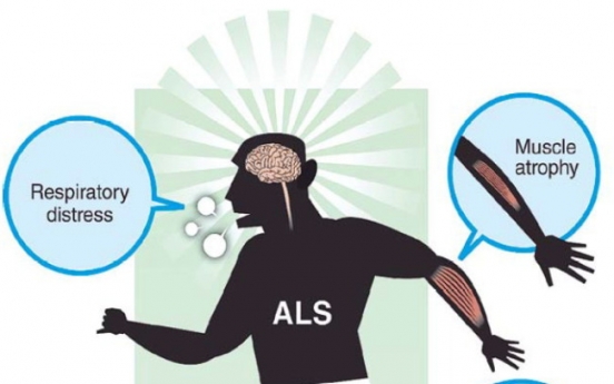 Amyotrophic lateral sclerosis