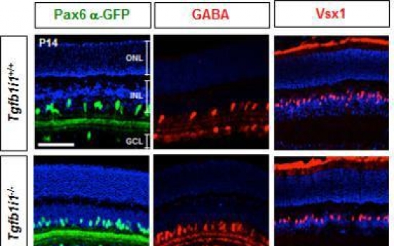 Scientists discover retina cell related to light sensitivity