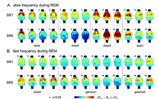 Scientists discover REM sleep's role in memory development