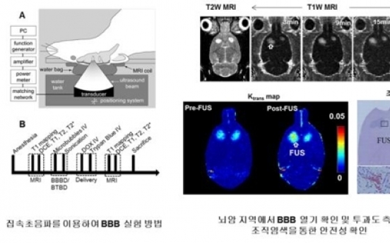 Scientists develop new drug treatment for brain cancer