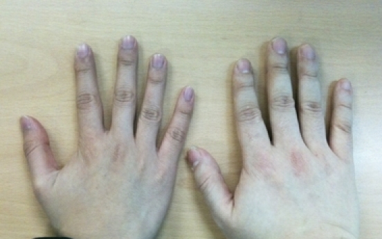 Length of ring finger related to men'<b>s</b> attractiveness