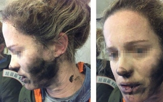 이번엔 기내서 헤드폰 배터리 폭발…호주 여성 화상