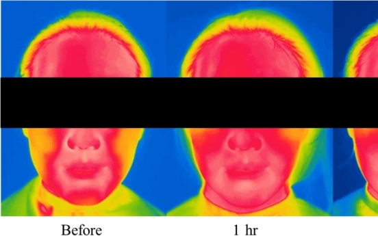Amorepacific study shows harmful impact of mask wearing on skin