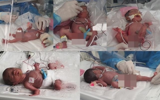 Quintuplets born in South Korea for first time in 34 years