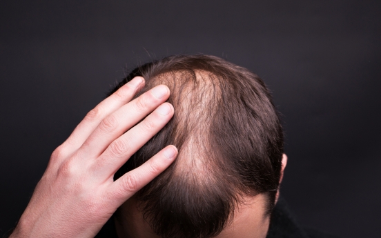 Alopecia expert recommends washing hair less to lose less