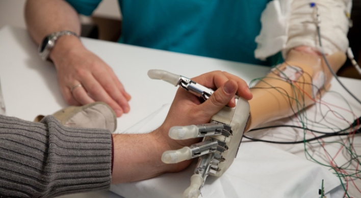 Experiment adds sense of touch to artificial hand