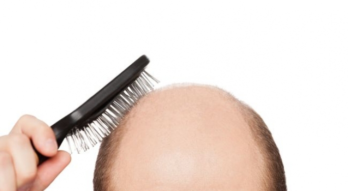 More men treated for hair loss