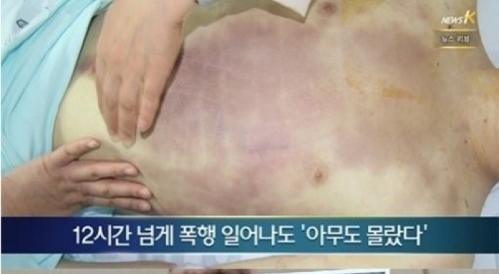 28사단 윤일병 사망사건, 군 수뇌부 문책 거론 관련 청와대 입장은...