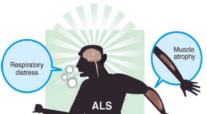 Amyotrophic lateral sclerosis