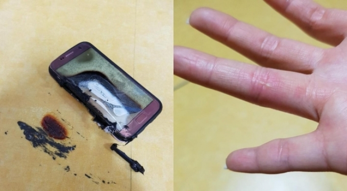 Alleged Samsung Galaxy S7 explosion causes severe burns