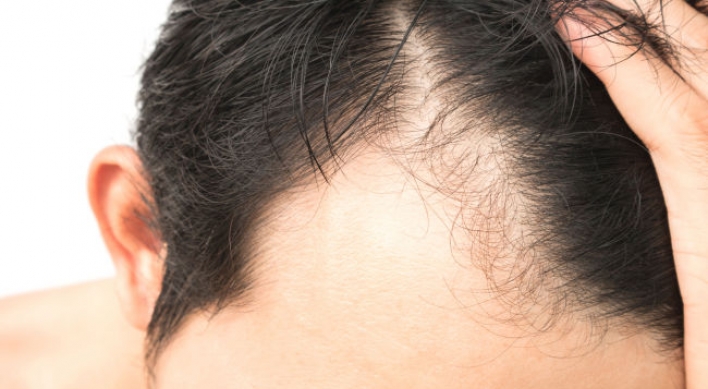 Korean scientists develop potential drug candidate for hair loss