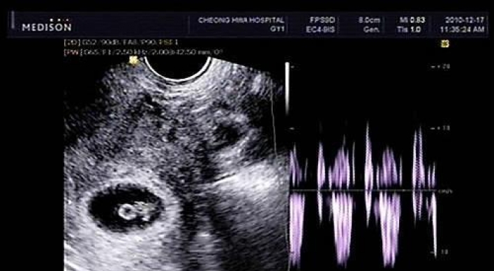 미국서 첫 자궁이식 출산 성공…스웨덴 이어 두번째