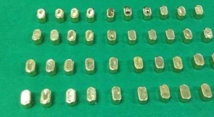 Women get prison terms for smuggling gold from China concealed in their bodies