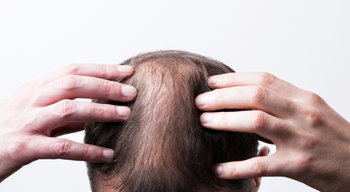 Municipalities offer subsidies for hair loss treatment