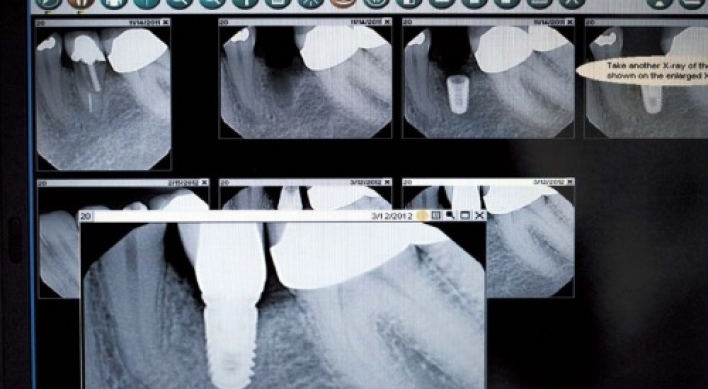 More people take longer-lasting options to replace missing teeth