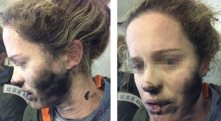 이번엔 기내서 헤드폰 배터리 폭발…호주 여성 화상