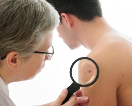 Skin cancer cases soar some 40% over 4 years
