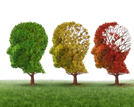 Half of Alzheimer’s patients show mild symptoms of dementia