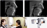 스마트 3D 시대, 잘못된 코재수술 3D CT 코성형으로 바로잡아